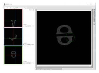 ct scanner software printscreen